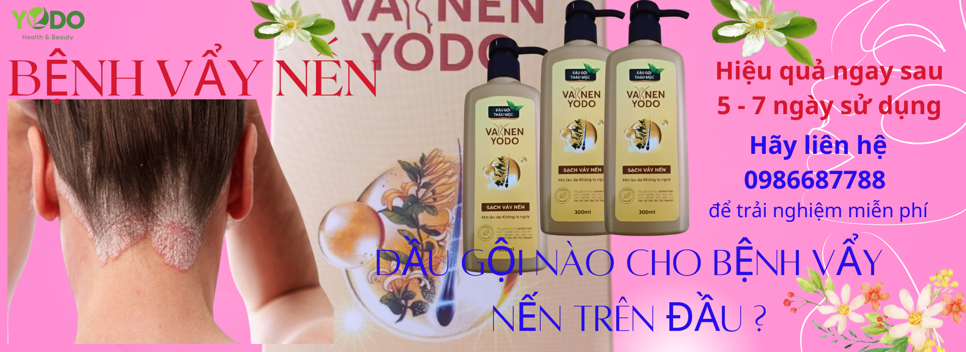 Tuyển đại lý