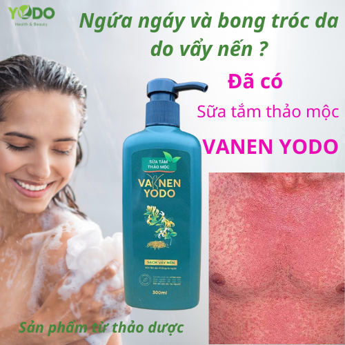 Giải pháp cho người bị ngứa ngáy, bong tróc da do vẩy nến, viêm da cơ địa từ thảo dược